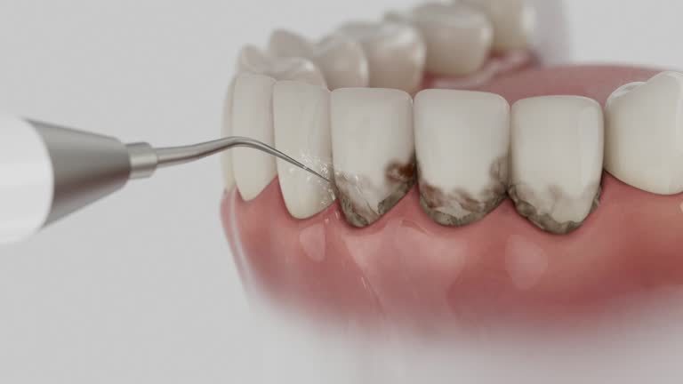 Reliable Tooth Extraction contractor in Gordon County County, GA by Dentist Open Now